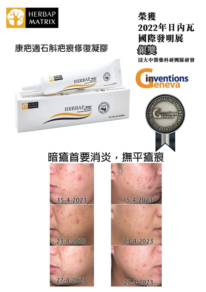 original (4).webp
