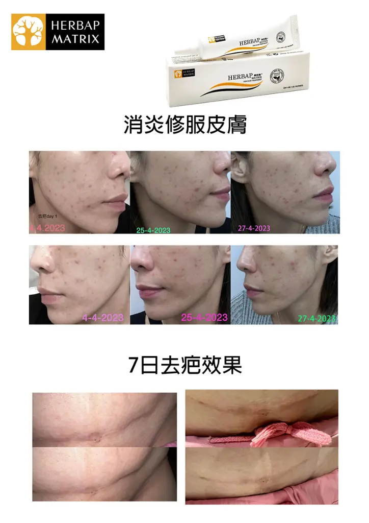 original (6).webp
