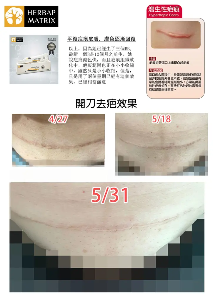 original (7).webp