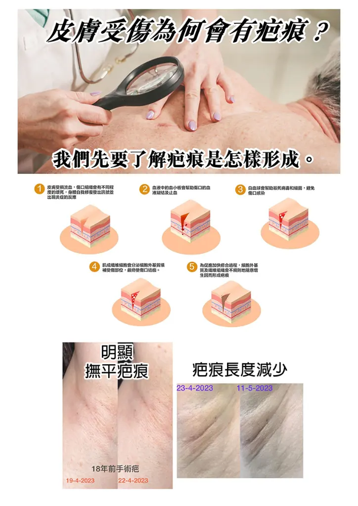 original (5).webp